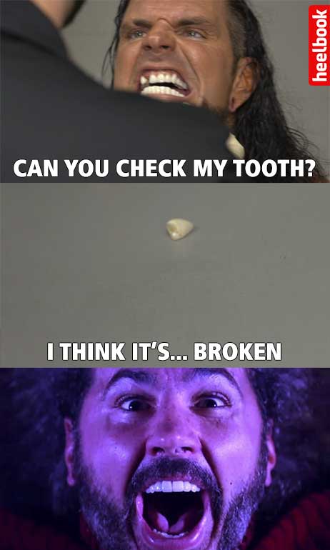 WWE Payback 2017 - Broken Tooth